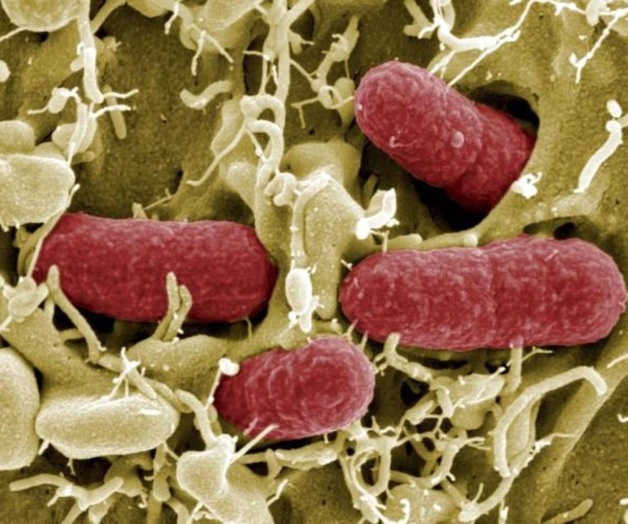 Mejoran sistema inmune de personas con VIH mediante trasplante de bacterias