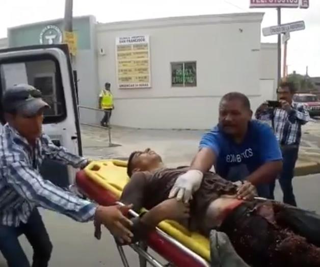 Bazuca le atrapa pie; se desangra y muere