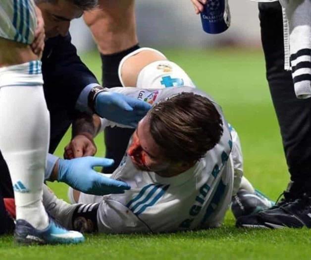 Sergio Ramos, capitán del Madrid sufre fractura en la nariz