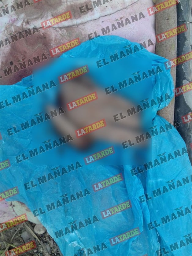 Hallan parte de mano cercenada tras volcadura