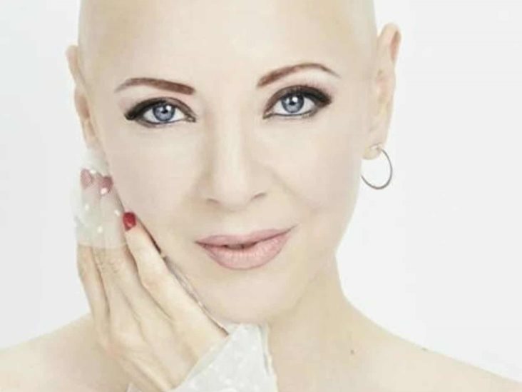 Edith González mostró su imagen sin cabello Edith González mostró su imagen sin cabello