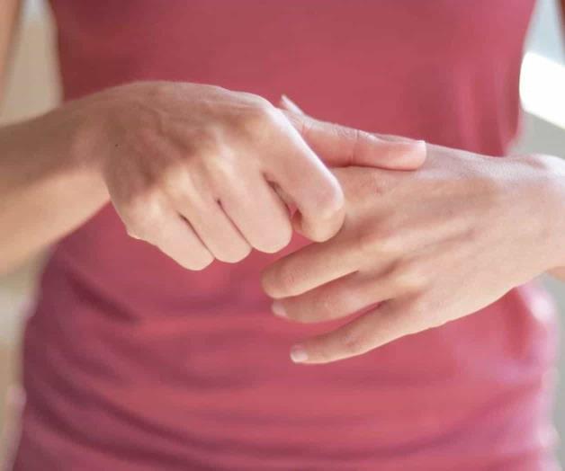 Tronar los dedos, práctica común que pude ocasionar deformaciones Tronar los dedos, práctica común que pude ocasionar deformaciones