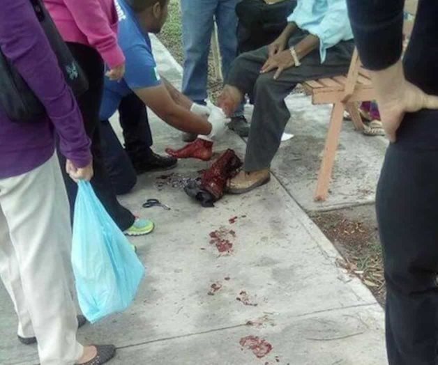 Sufre ataque  de Rottweiler