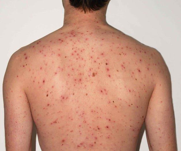 Por lo pronto, sólo una amonestación Por lo pronto, sólo una amonestación