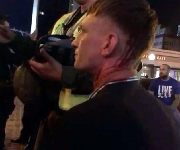 Atacan a fans del Liverpool en Kiev