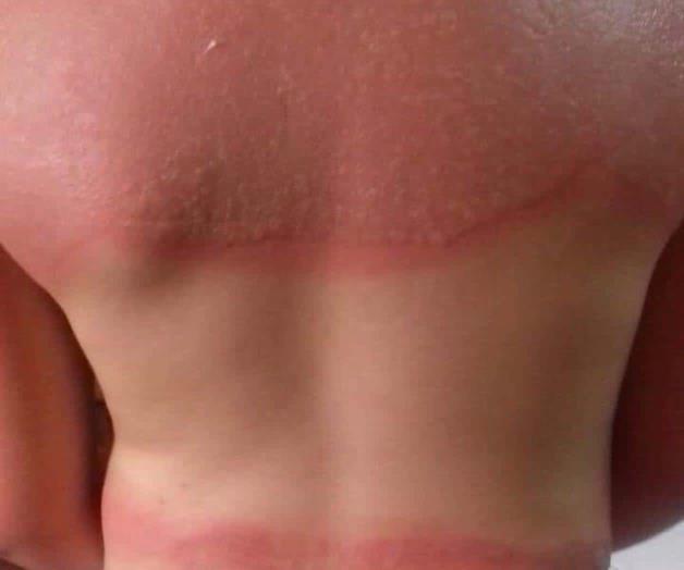 Llaman a evitar los bloqueadores ‘patito’ Llaman a evitar los bloqueadores ‘patito’