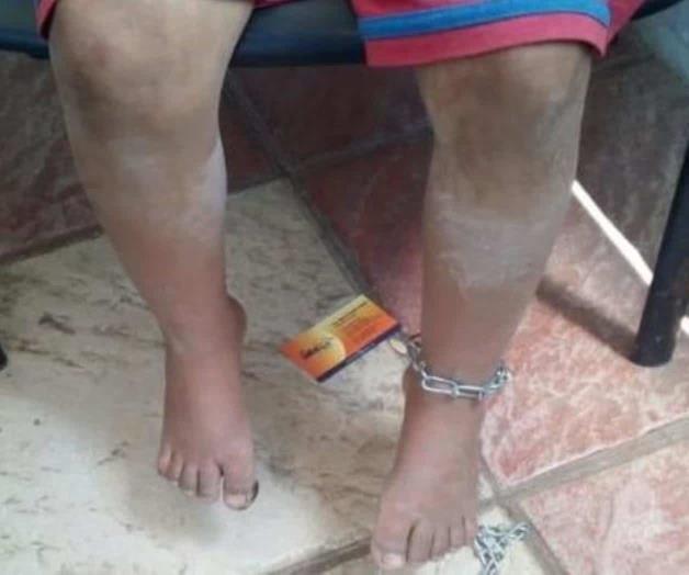 Aguascalientes: Rescatan a dos niñas golpeadas y encadenadas Aguascalientes: Rescatan a dos niñas golpeadas y encadenadas