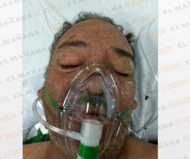 🎥 Sufre abuelito brutal ataque de abejas 🎥 Sufre abuelito brutal ataque de abejas