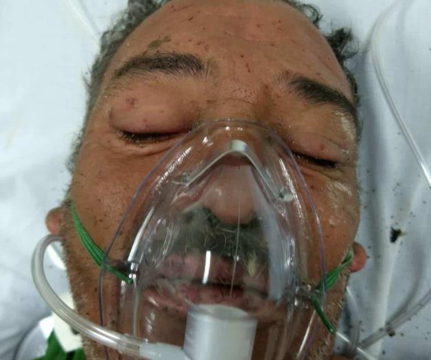 Reportan evolución favorable de abuelito atacado por abejas Reportan evolución favorable de abuelito atacado por abejas