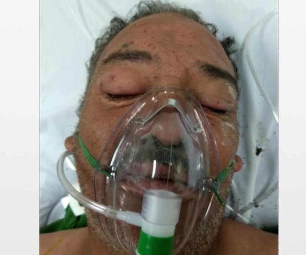 Mejora el abuelito atacado por las abejas Mejora el abuelito atacado por las abejas