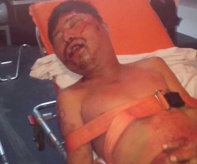 Fallece tras recibir una severa golpiza Fallece tras recibir una severa golpiza