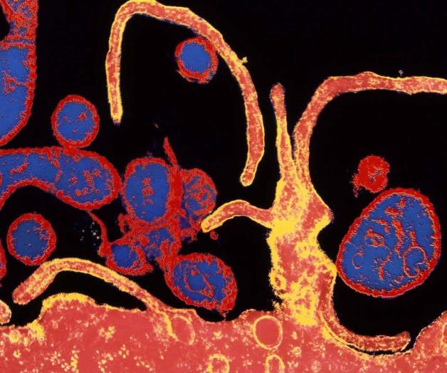 Brote récord de sarampión despierta alarma en Europa Brote récord de sarampión despierta alarma en Europa