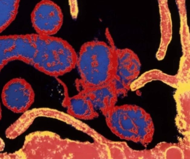 En alerta Europa tras brote de sarampión En alerta Europa tras brote de sarampión