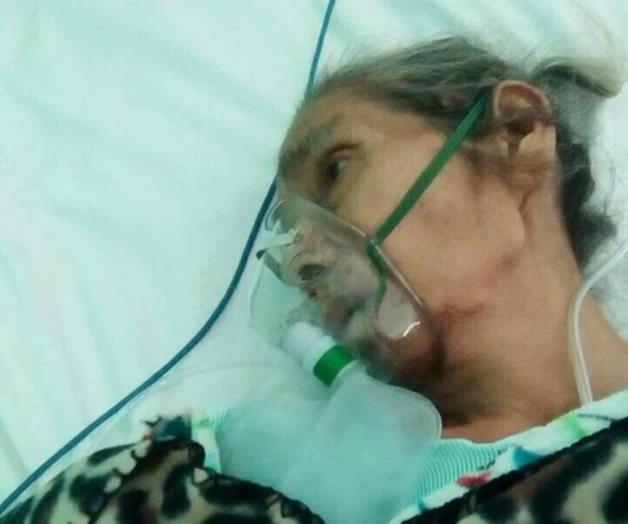 Complica neumonía salud de enferma con Alzheimer Complica neumonía salud de enferma con Alzheimer