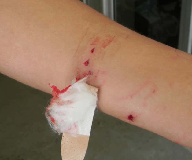 Finaliza canícula; sigue agresividad. Llamado a no provocar a los animales Finaliza canícula; sigue agresividad. Llamado a no provocar a los animales