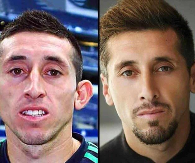El radical cambio de Héctor Herrera El radical cambio de Héctor Herrera