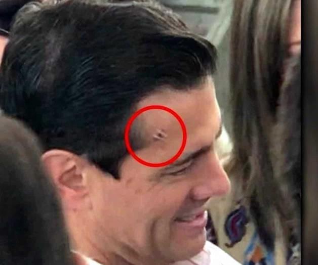 Luce Peña Nieto golpe en la frente