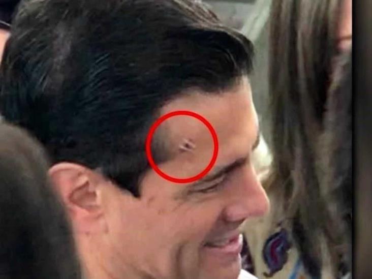 Luce Peña Nieto golpe en la frente Luce Peña Nieto golpe en la frente