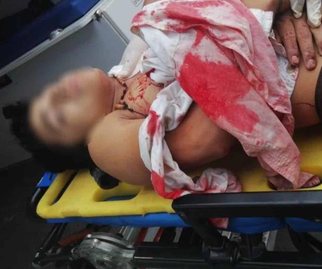 SAN FERNANDO: Atentan contra migrantes en brecha