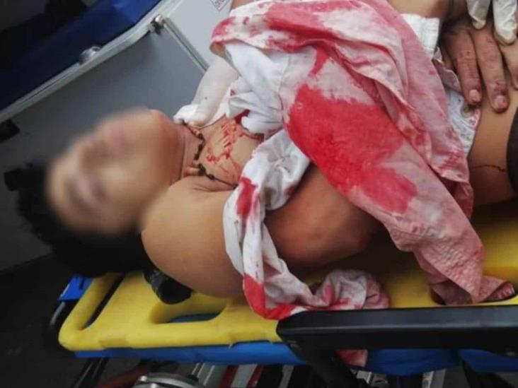 SAN FERNANDO: Atentan contra migrantes en brecha SAN FERNANDO: Atentan contra migrantes en brecha