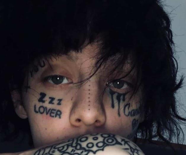 Va a rehabilitación