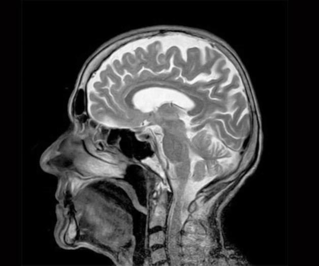 Así se diferencia el cerebro de un psicópata