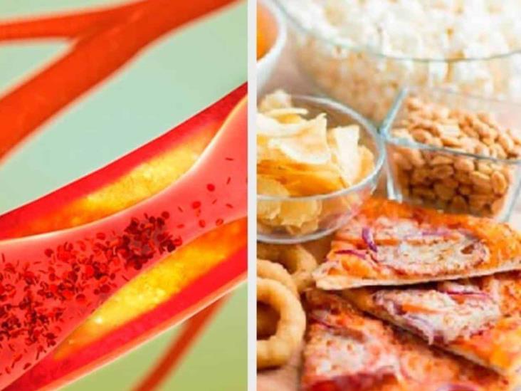 Alimentos que pueden tapar las arterias Alimentos que pueden tapar las arterias