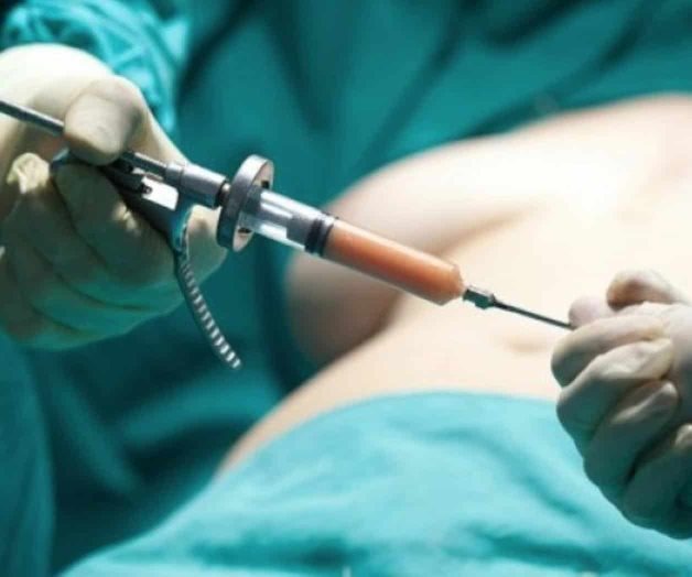 Muere mujer tras someterse a una liposucción, en Monterrey