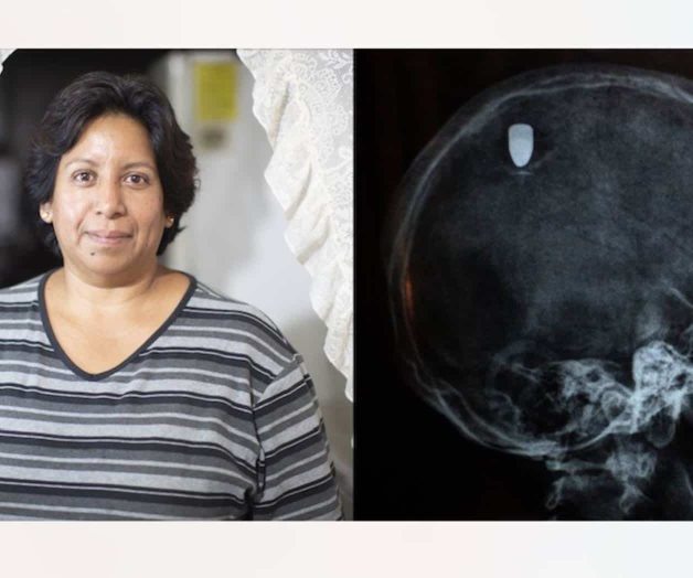 Pocas son las probabilidades de sobrevivir a un balazo en la cabeza... Lourdes lo logró