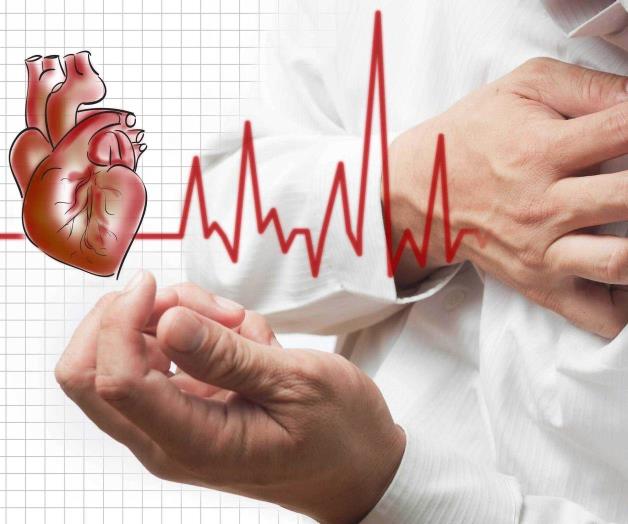 Aplican en IMSS Código de Infarto Aplican en IMSS Código de Infarto