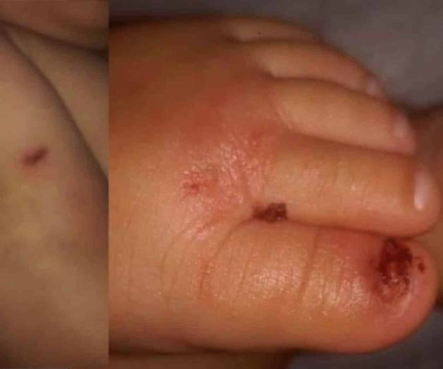 Denuncia que madre de sus hijos y su novio maltratan y abusan sexualmente de su bebé