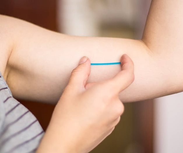 Guadalajara:  200 implantes anticonceptivos gratuitos 