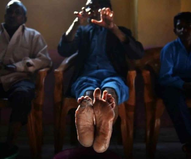 Japón acepta indemnizar a familias de pacientes con lepra