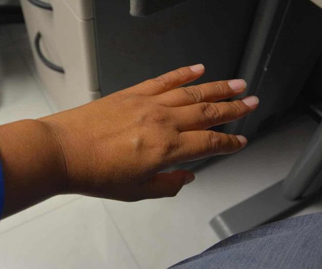 Cuidado: evite las radiaciones solares