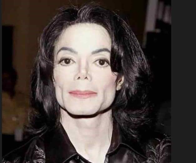 Michael Jackson murió calvo y con cicatrices en el cuerpo Michael Jackson murió calvo y con cicatrices en el cuerpo