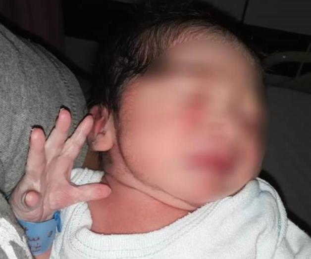 Sobrevive bebé de madre sin líquido amniótico