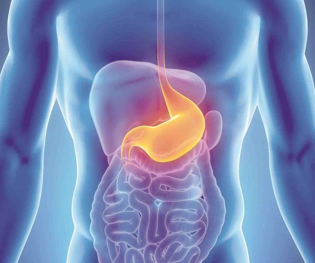 Gastritis: causas y síntomas