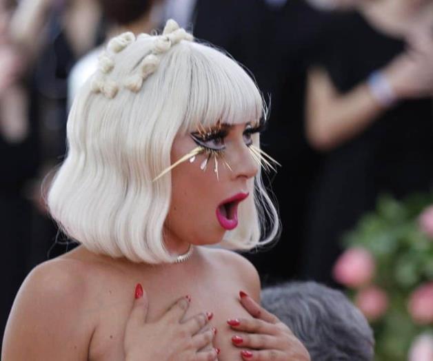 Lady Gaga se recupera de caída Lady Gaga se recupera de caída