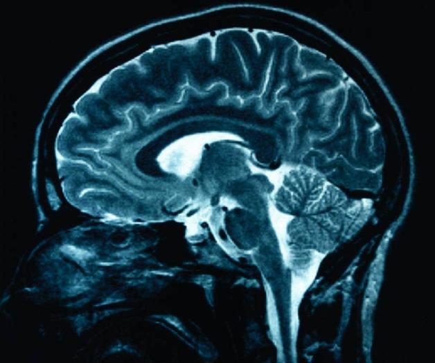 Reconstruyen imágenes de la actividad cerebral