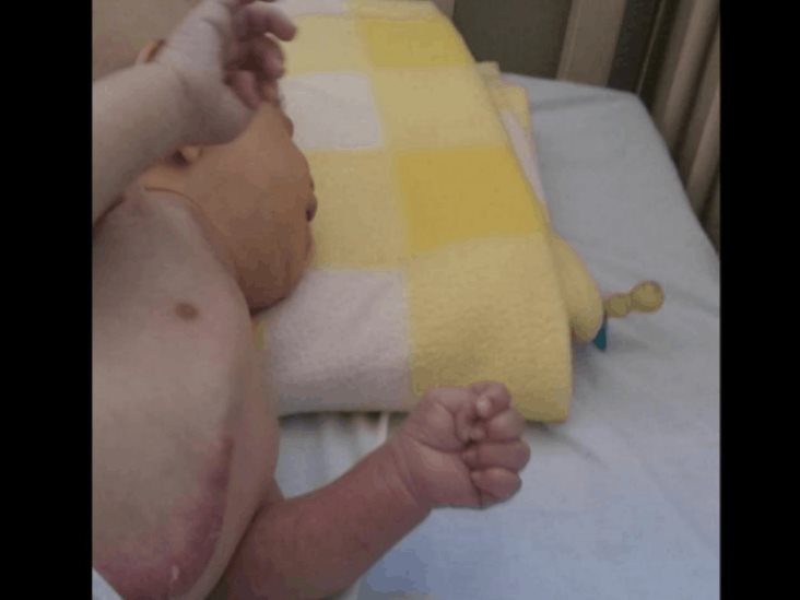 Claman por ayuda para salvar a bebé Claman por ayuda para salvar a bebé