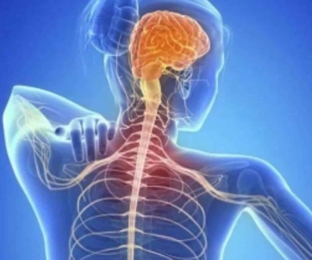 Esclerosis múltiple se asocia con disfunción sexual Esclerosis múltiple se asocia con disfunción sexual