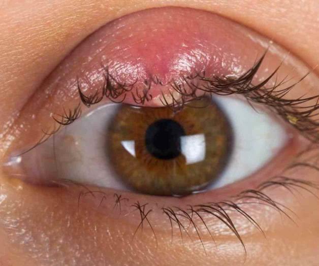 Especial cuidado en área de ojos Especial cuidado en área de ojos