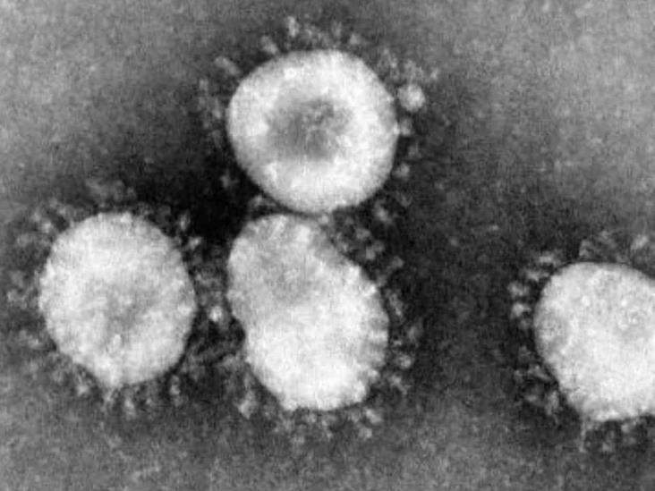 OPS insta países a la detección temprana de coronavirus OPS insta países a la detección temprana de coronavirus