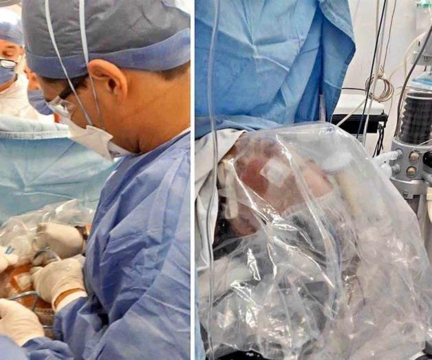 Cubren con plástico rostro de paciente Cubren con plástico rostro de paciente