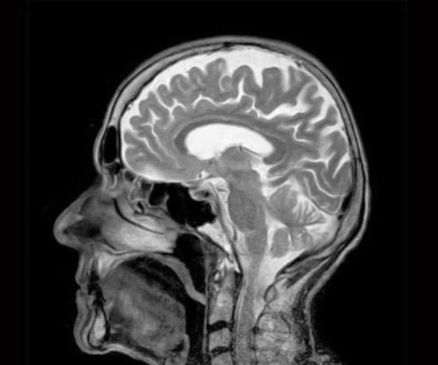 El cerebro tiene una función integrada y no separada: Estudio