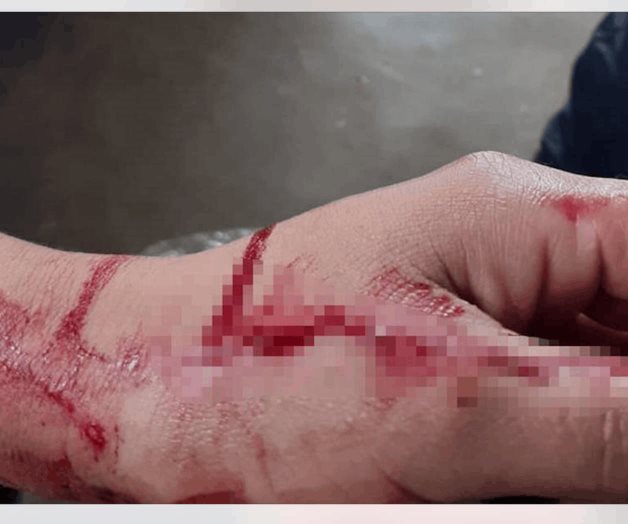 Se corta venas, pero sobrevive