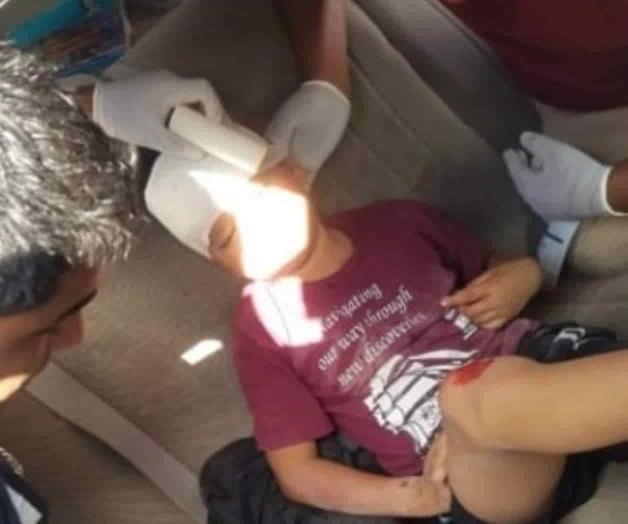 Menor cae de motocicleta, resulta herido Menor cae de motocicleta, resulta herido