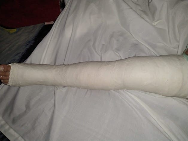 Piden apoyo para niño atropellado; cafre huyó