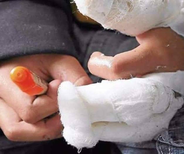 Explotan juegos pirotécnicos en las manos de un menor