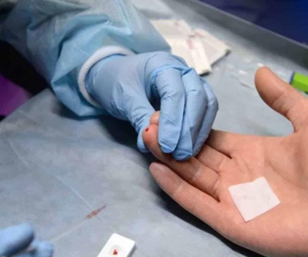 Controladores del VIH: Identifican pacientes con baja carga viral